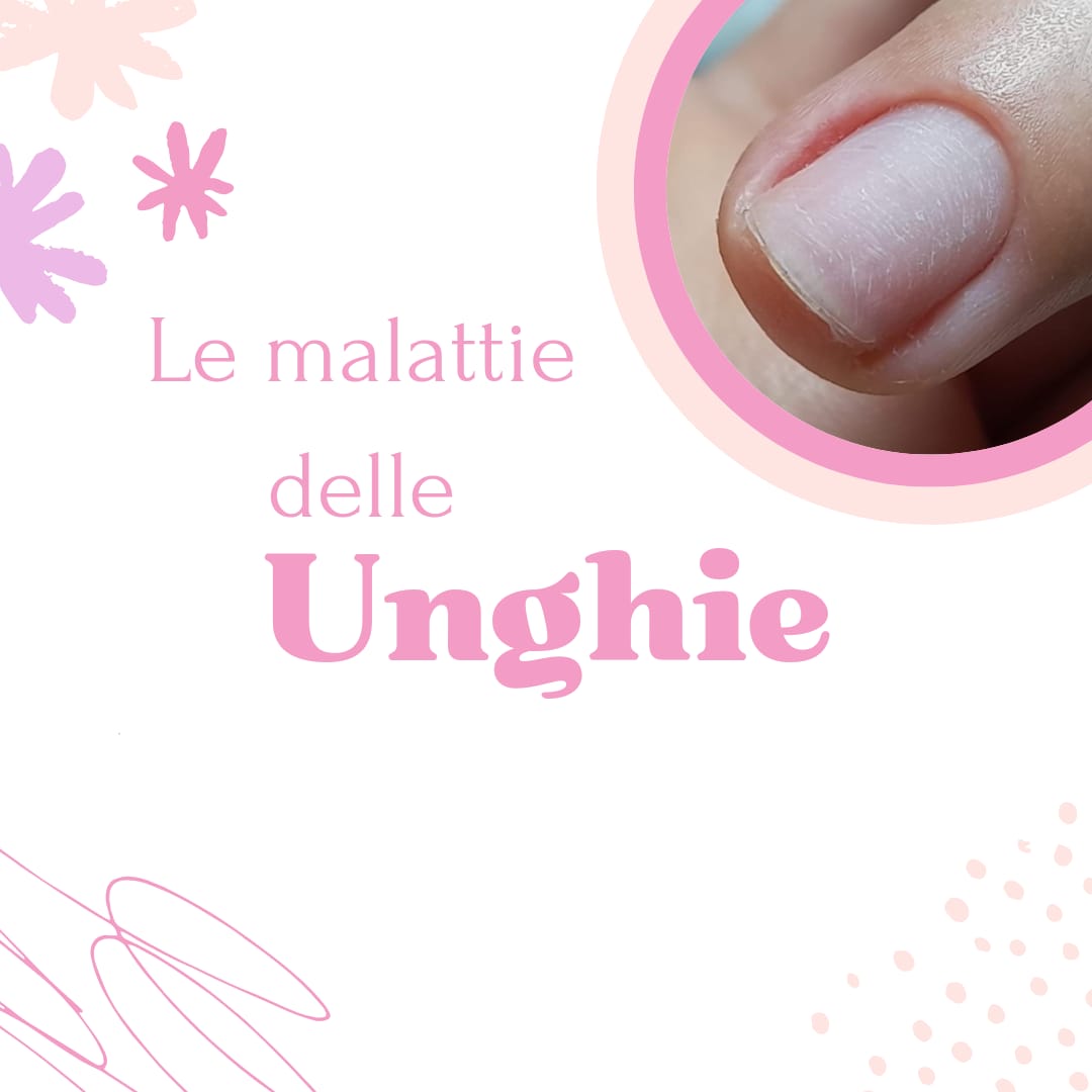 Malattie delle Unghie – Guida PDF Professionale