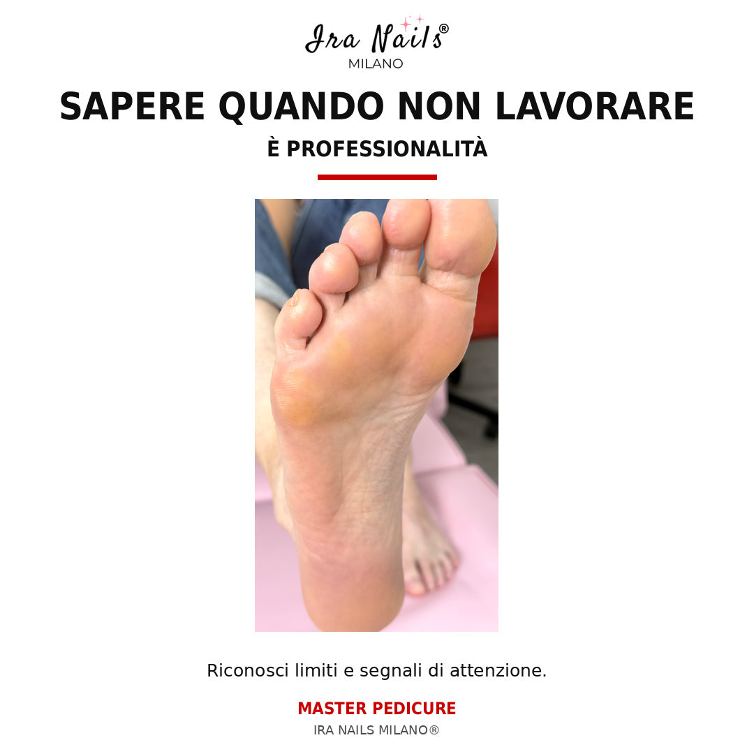 Corso Master Pedicure Ira Nails Milano per riconoscere segnali di attenzione, controindicazioni e situazioni in cui non eseguire il trattamento