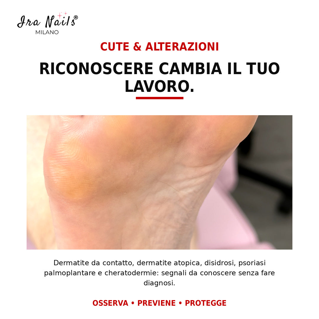 Corso Master Pedicure Ira Nails Milano per osservare e riconoscere i segnali delle principali alterazioni cutanee del piede senza formulare diagnosi