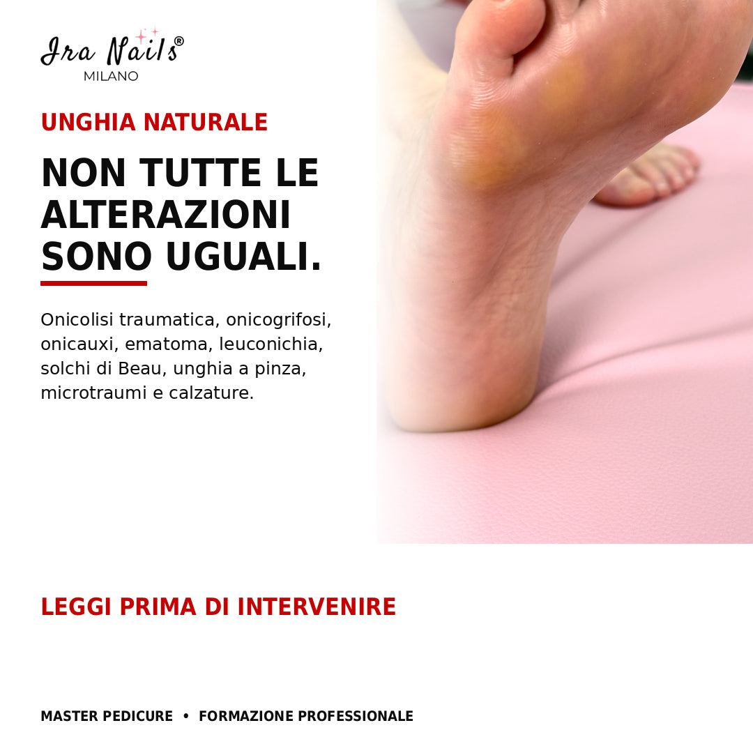 Corso Master Pedicure Ira Nails Milano per riconoscere le alterazioni dell’unghia naturale e valutare correttamente prima di intervenire