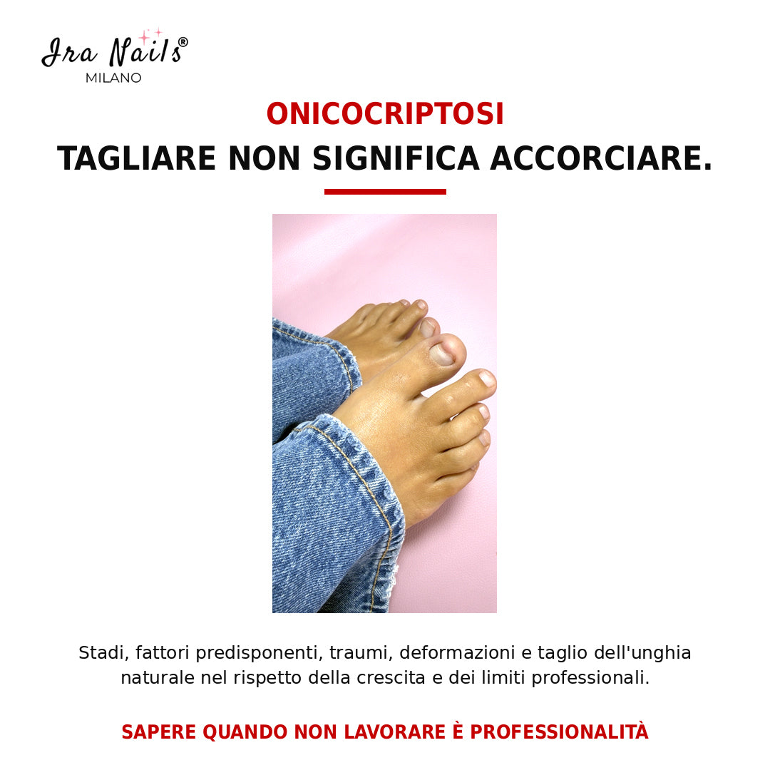 Corso Master Pedicure Ira Nails Milano sull’onicocriptosi, il taglio corretto dell’unghia naturale e i limiti professionali del trattamento